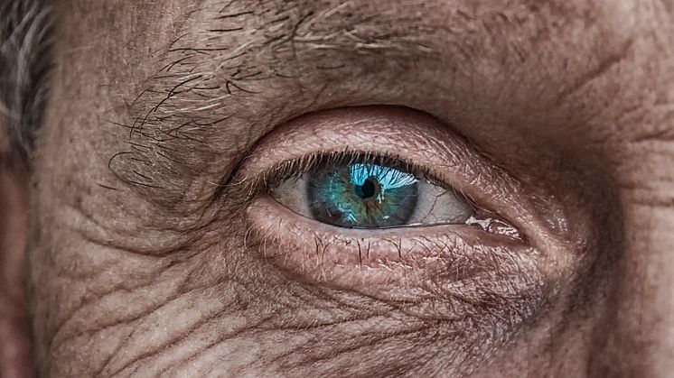Ny ögonundersökning kan upptäcka Alzheimers sjukdom år innan symtom uppträder, enligt ny studie Pixabay CCO