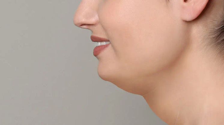 Health dangers of a fat neck | Mewing | Jawline Liposuction