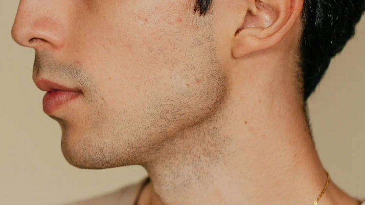 double-chin.webp