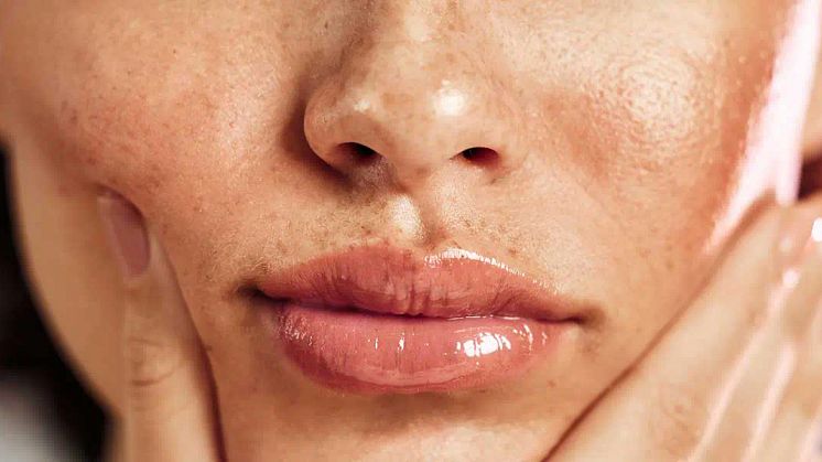 Bye Dull Skin! Get Skin Rejuvenation with PICO Fractional Laser