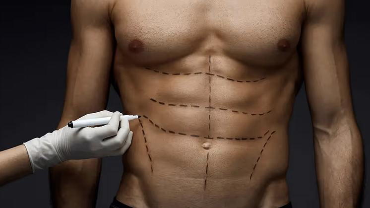 'Six-pack surgery' gaining popularity among men in Singapore | Abdominal Etching