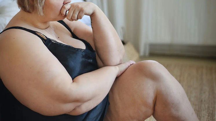 How to Spot if I have Lipedema? Self-Diagnosing Lipedema at Home