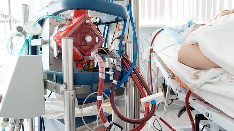 VentriLabs´ innovative gravity pump technology can be used for gentle pumping of blood.