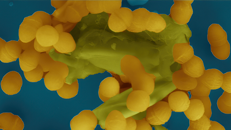 Bild från elektronmikroskop som visar hur Enterococcus faecalis-bakterier klumpar ihop sig för att dela bland annat antibiotikaresistens med varandra.