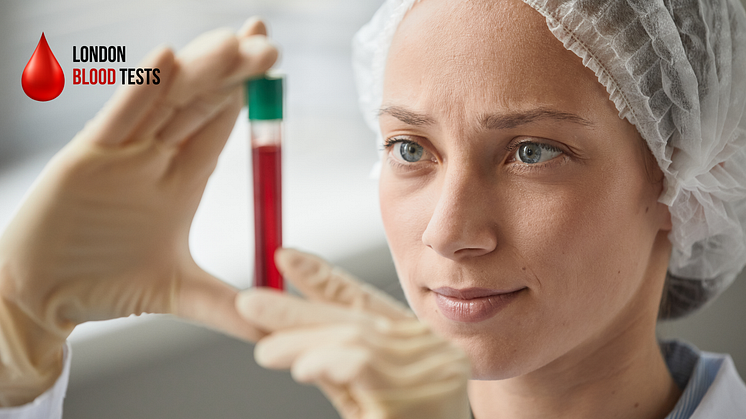 london-blood-tests-cancer-testing-near-me-glasgow.png