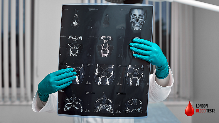 London Blood Tests introduces xrays in the comfort of your own home. Contact us to find out more.