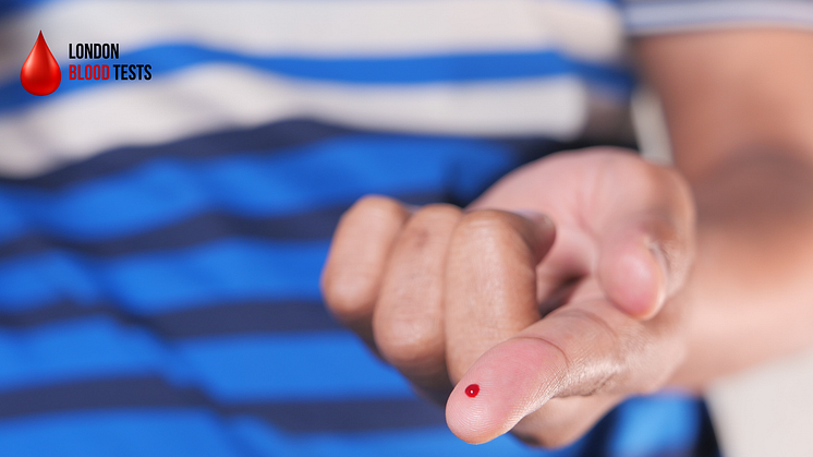 London Blood Tests offers a private testing alternative, order your Vitamin B12 Blood Test Kit, collect a blood sample using a finger prick, and send back the test to our laboratory.