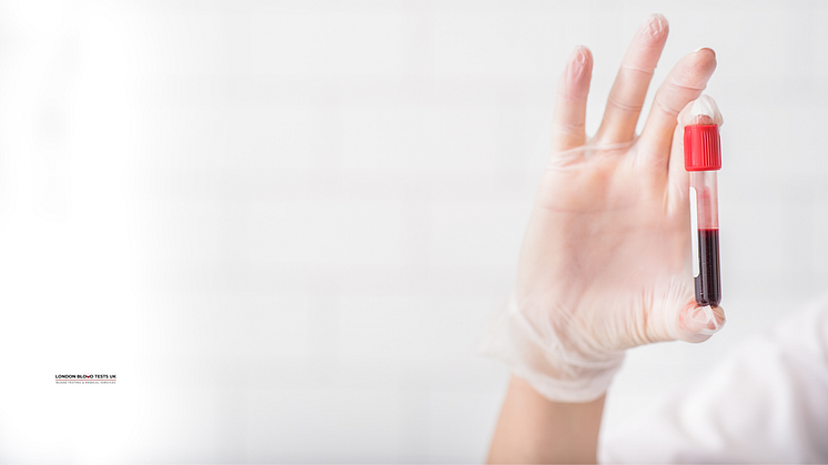 New Acute Med 2 blood test, a complete health check covering 60+ vital markers. Book today!