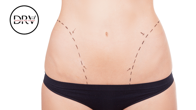 DRV Clinic Launches Advanced Tummy Tuck Procedures to Revolutionise Post-Pregnancy Recovery