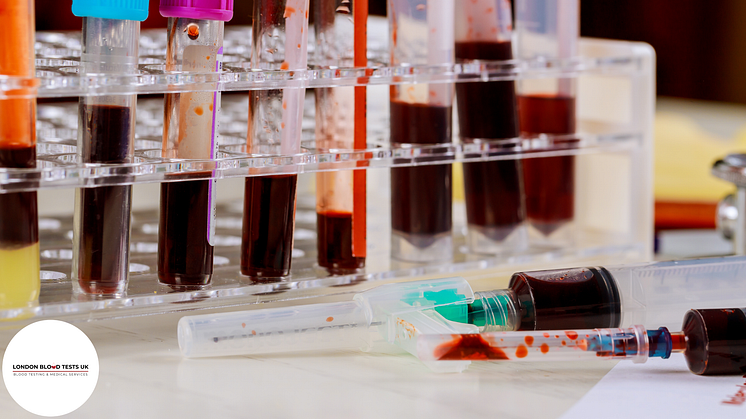Home organic acid & toxin test kits now available across the UK. Book with us today.