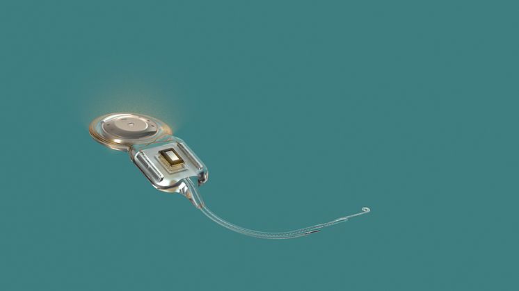 Das beigefügte Foto dürfen Sie im Zusammenhang mit unserer Meldung frei verwenden. Bildunterschrift: Weltweit erstes smartes Cochlea-Implantat-System – Cochlear gibt die Markteinführung von Cochlear™ Nucleus® Nexa™ bekannt (Foto: Cochlear Ltd.)