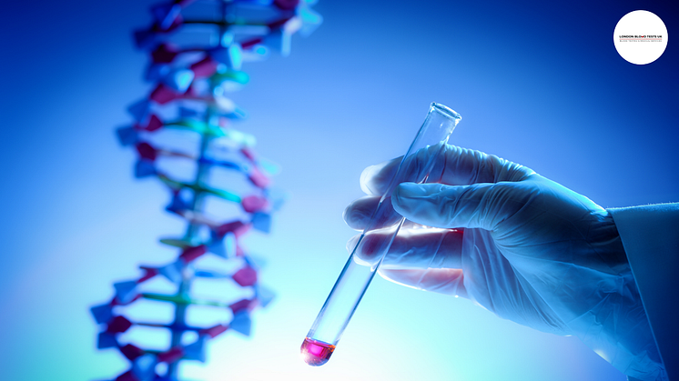 Get a genetic lactose intolerance test in London, in clinic or at home for just £60 extra.