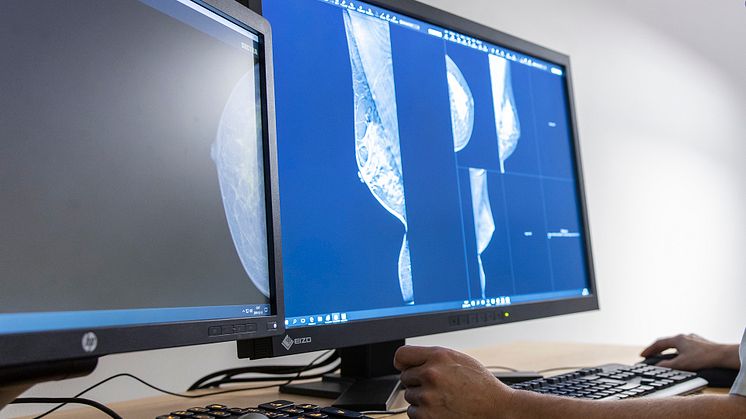 Forskningssammanställningen ”Artificiell intelligens vid bröstcancerscreening med mammografi” är gjord av HTA syd vid Skånes universitetssjukhus och sakkunniga inom området. 