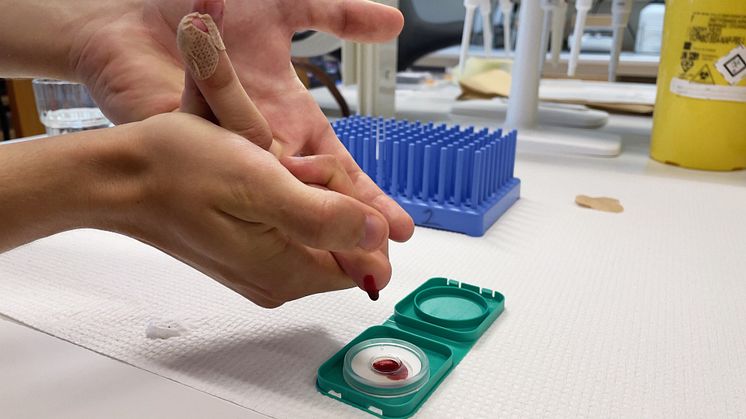 Ny metod gör det möjligt att screena för autoimmuna sjukdomar i stor skala 