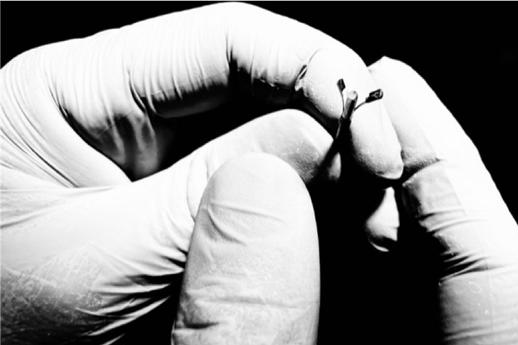 Ny revolutionerande automatisk teknik för cancerbehandling på några minuter utvecklad av Multi4 AB 