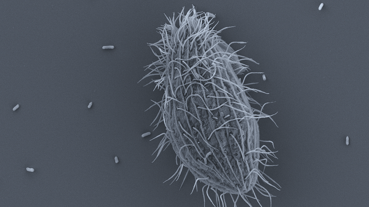 Bakterier som kan orsaka sjukdom hos människor kan gynnas av klimatförändringar. På bilden syns bakterier runt ett möjligt värddjur (en ciliat). Foto: Karolina Eriksson
