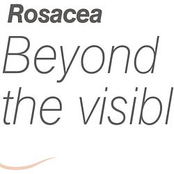 Rosacea