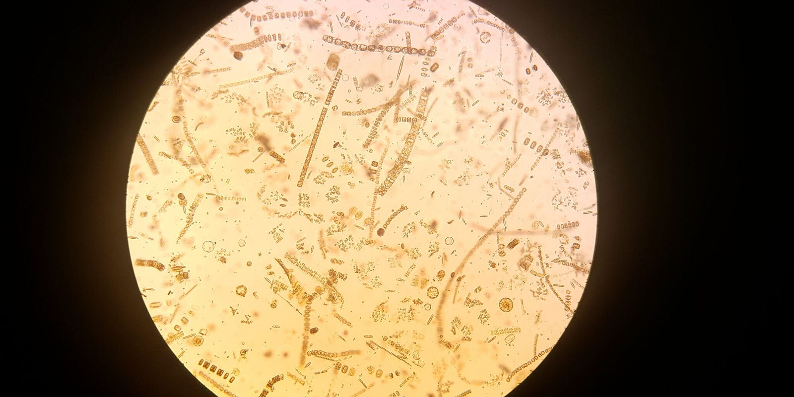 Through a microscope, the stunning diversity of phytoplankton becomes obvious. These specimens were sampled in Van Mijenfjorden during the spring bloom (Photo: Ane Cecilie Kvernvik)