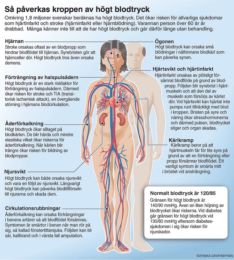 Högt blodtryck - så påverkas kroppen