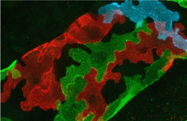 Lymphatic endothelial cells