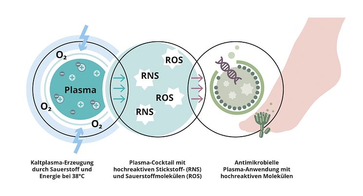 Kaltplasma in der Podologie