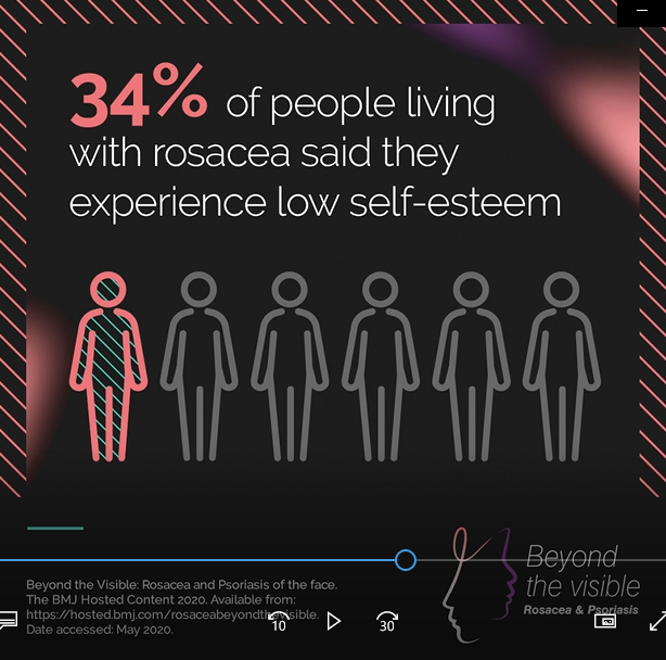 34% av personer som lever med rosacea säger att de har låg självkänsla