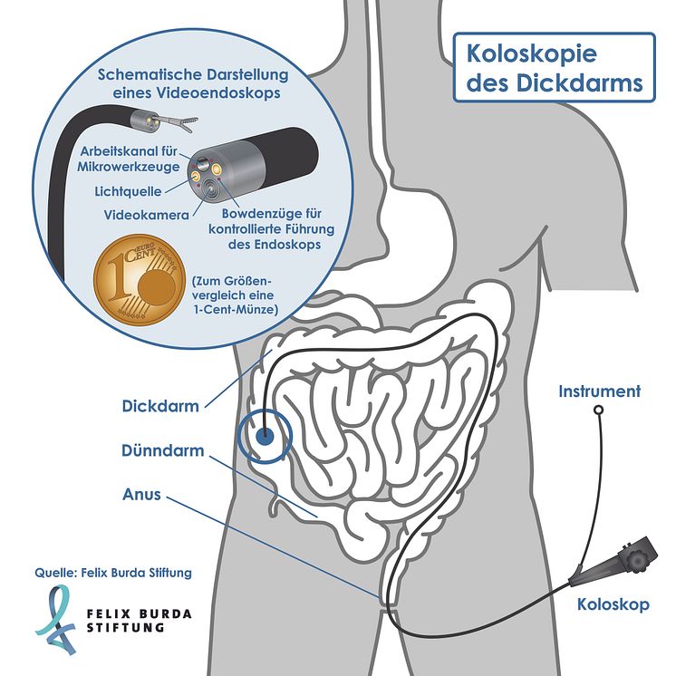 Korpus: Darmspiegelung