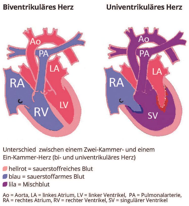 Biventrikuläres-Herz_Univentrikuläres-Herz_Universität-Kansas2023