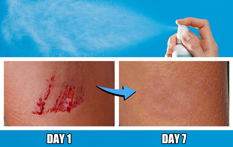 Active Skin Repair 4