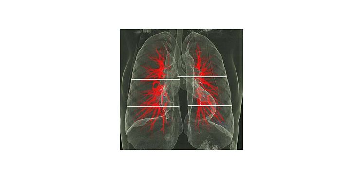 Lungor översikt 3D