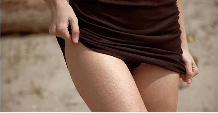 6194542f93a498ffad79f02f_fat-thigh-chafing-liposuction-singapore