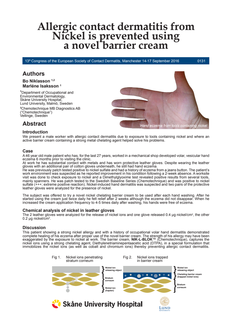 Allergic contact dermatitis from nickel is prevented using a novel barrier cream