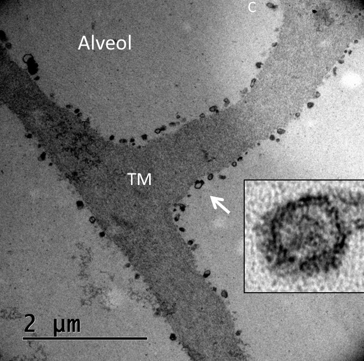 Alveoli which are assumed to shaped by enzymatic activity by exosomes