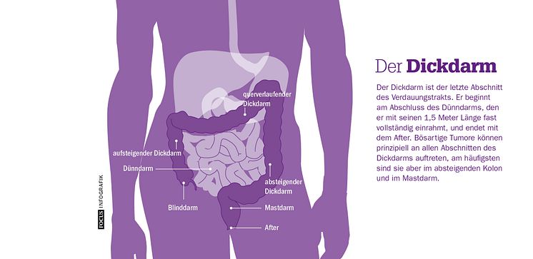 Der Dickdarm. FOCUS Infografik