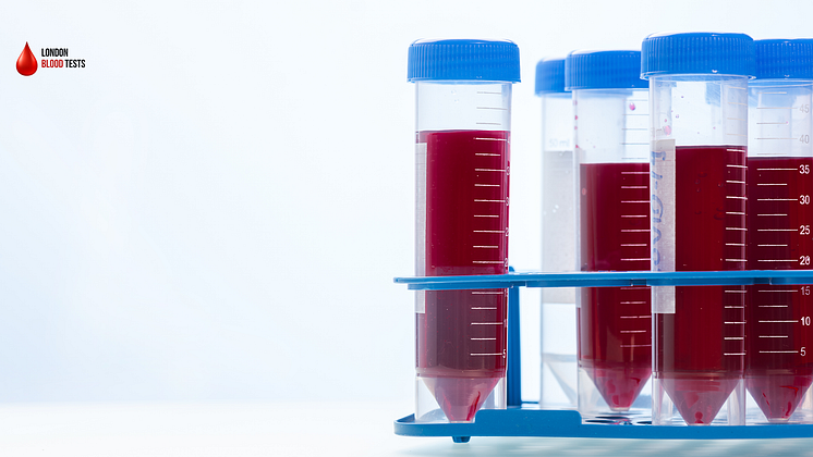 london-blood-tests-fsh-testing-near-me.png