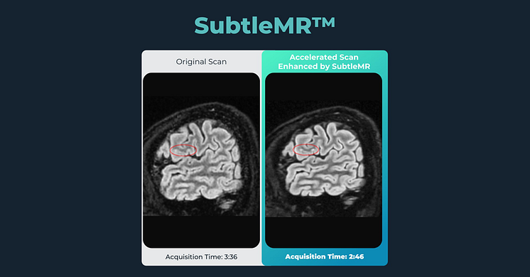 IMG-Subtle-Medical’s-AI-powered-Imaging-Technology