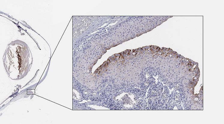 ACE2 in the conjunctiva of the eye