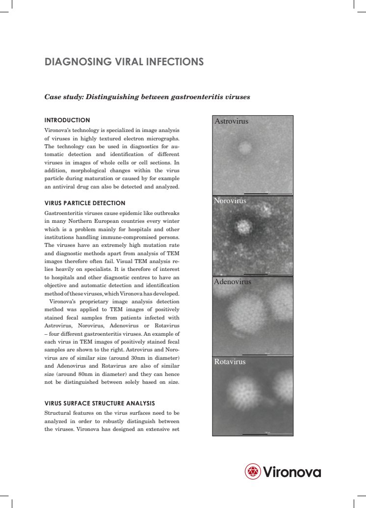 Diagnosing Viral Infections 