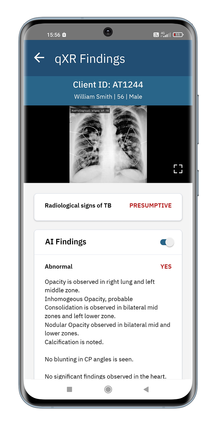 1. AI Findings_Radiology Workflow