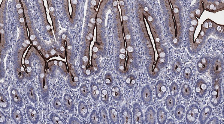 ACE2  in the  small intestine