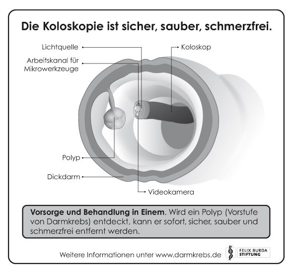 Darmkrebsvorsorge mittels Darmspiegelung