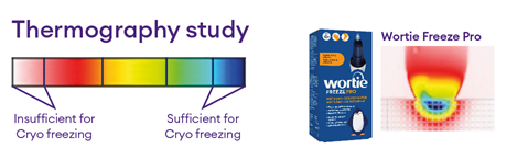 Wortie Freeze Pro Thermography Study