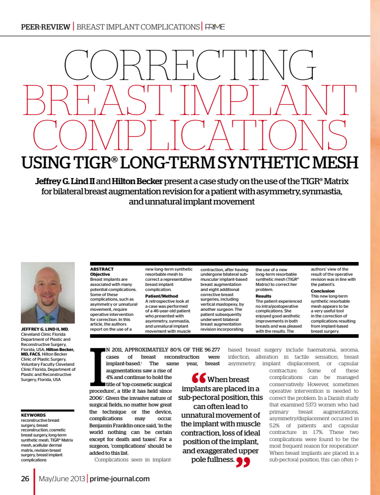 New Peer-Review highlights the benefits of using TIGR® Matrix for correcting breast implant complications