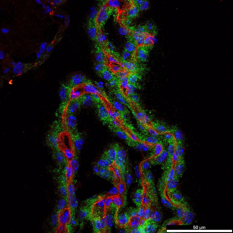 Musens choroid plexus