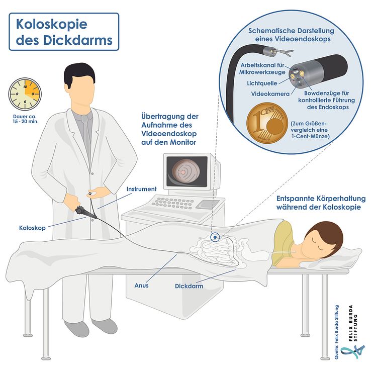 Koloskopie des Dickdarms