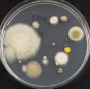 A variety of fungi commonly observed from face masks after a single-day use