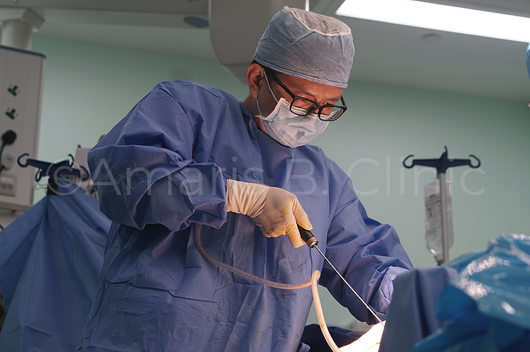 Dr Ivan Puah, Liposuction Doctor In Singapore, Shares The Secret To Achieving A Good Liposuction Result