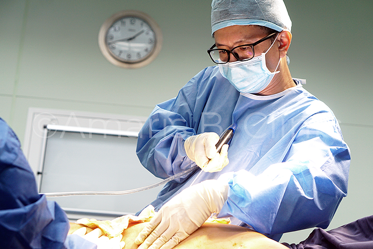 DR. IVAN PUAH - LIPOSUCTION DOCTOR AND CREATOR OF MDC-LIPO SCULPT®️ TECHNIQUE