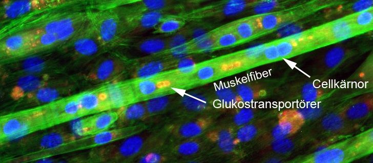 Bild på muskelfiber