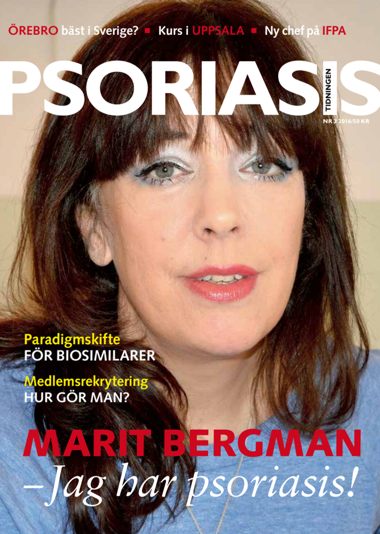 Marit Bergman: Jag har psoriasis!